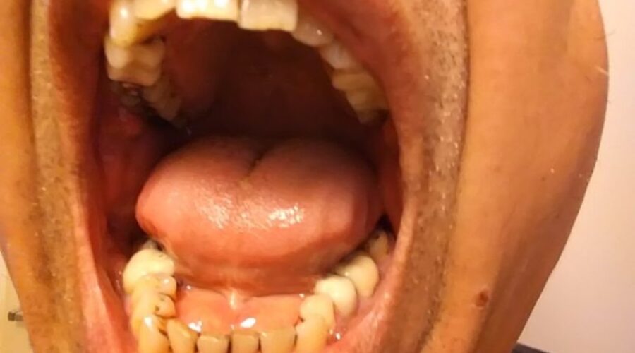 CDA Applauds Dental Care In Federal Budget