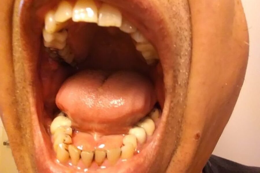 CDA Applauds Dental Care In Federal Budget