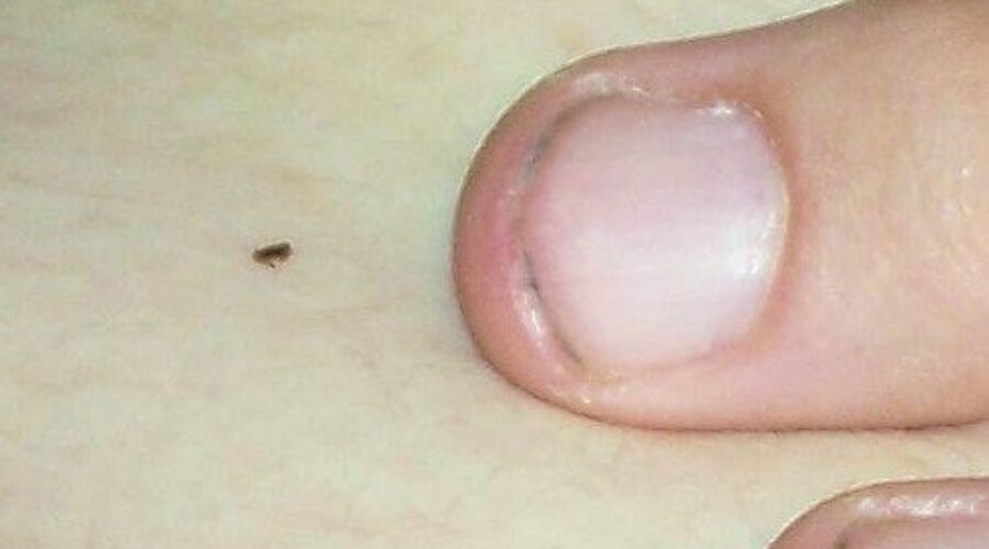 Expert suggests thorough check for ticks after outdoor adventures