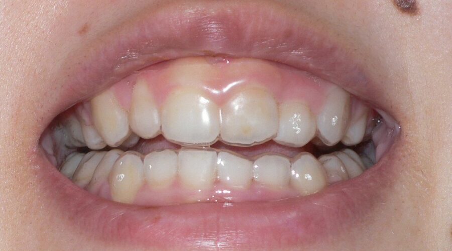 Better dental care for children and people with special needs