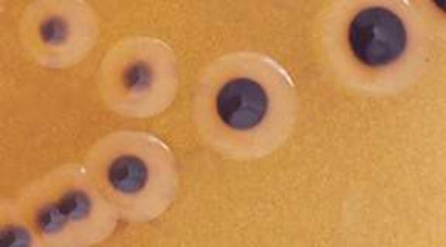 Outbreak of drug-resistant salmonella infections found in Canada: Public Health