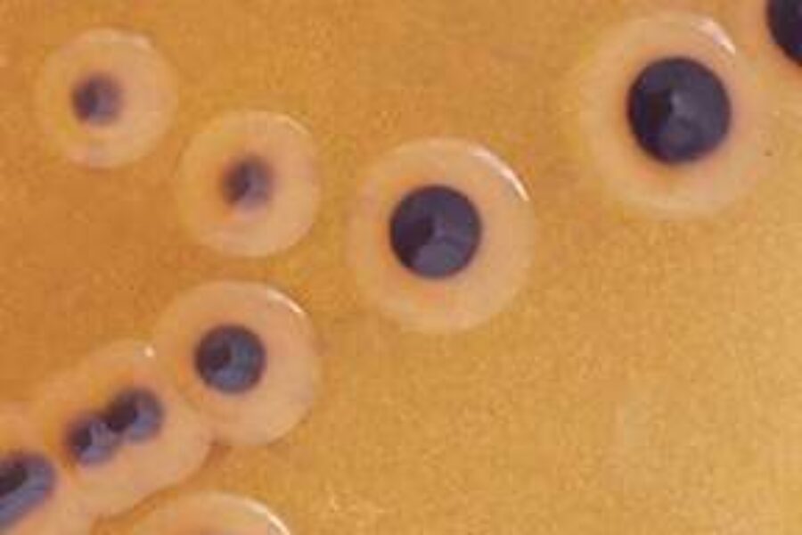 Outbreak of drug-resistant salmonella infections found in Canada: Public Health