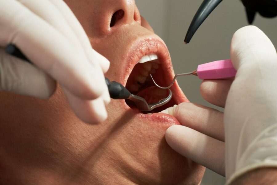 National dental plan details revealed