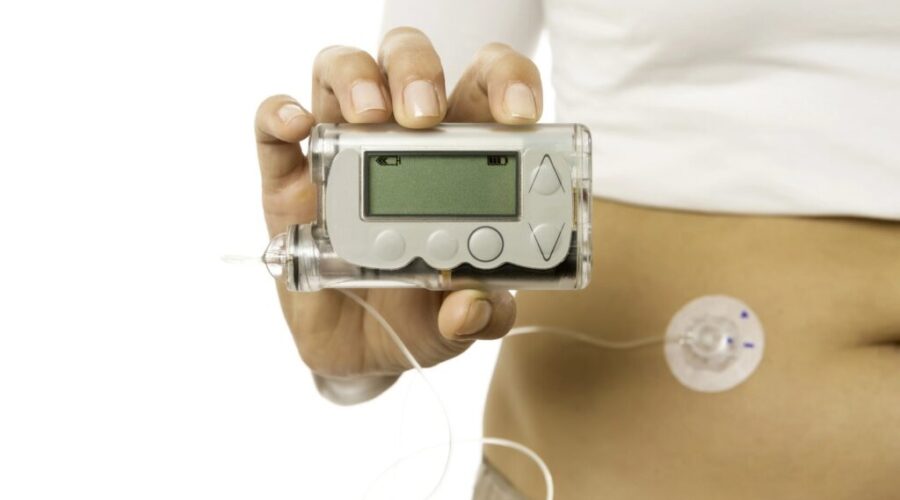 N.S. ditches age cap for insulin pump funding program