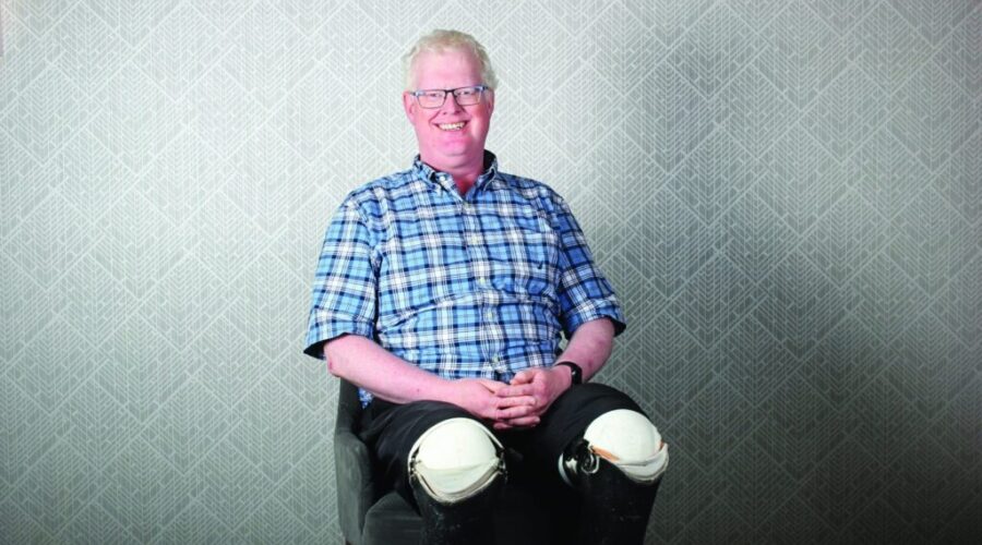 War Amps seminar for child amputees celebrating 50 years in Halifax