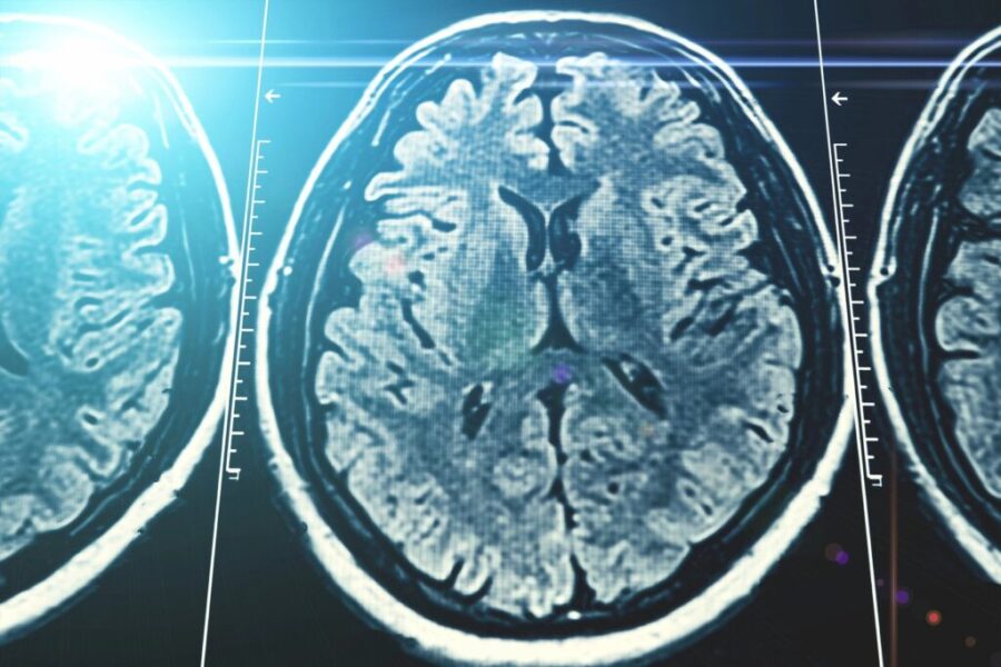 Stigma keeps many Canadians from seeking dementia help